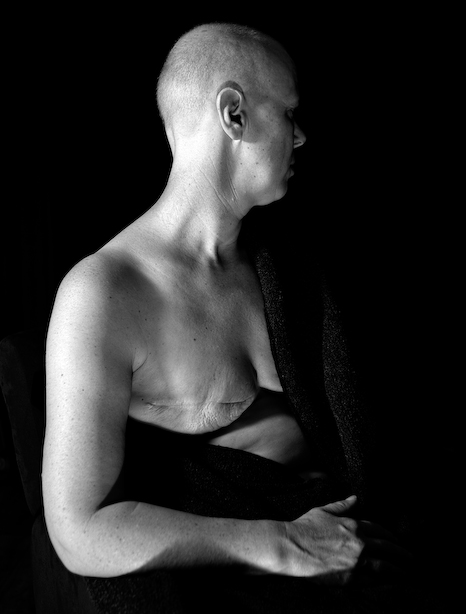 The Netherlands, Voorthuizen, November 2005.
Breast cancer 3.
Janet suffering from breast cancer.
